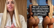 Juju Ferrari é hospitalizada com infecção grave nos glúteos; veja como está