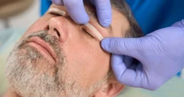 Blefaroplastia segura previne complicações graves