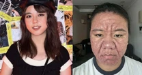 Mulher malaia choca ao exibir mudança extrema na pele durante a gravidez, vídeo viraliza e rebate críticas à sua aparência: 'Afeta minha saúde mental'