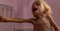Fome é confirmada na Cidade de Gaza pela primeira vez, diz órgão ligado à ONU