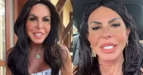 Gretchen solta o verbo após ser atacada por mulheres: 'Recalcadas'