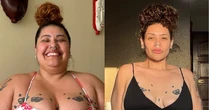 Ex-participante do The Voice Brasil mostra antes e depois de perder 90 kg com cirurgia bariátrica
