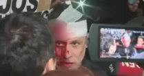 Jornalista fica gravemente ferido em evento de Milei