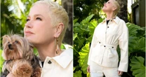 Transplante capilar de Xuxa já tem resultado: saiba quanto custa e quem pode fazer