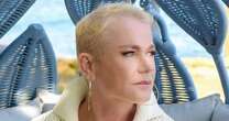 Xuxa faz implante capilar e sonha em usar penteado clássico