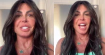 Gretchen revela novo visual após correções estéticas: 'Meu novo rosto'
