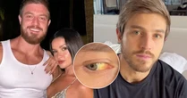 É grave? Namorado de Juliette recebe alta, mas segue com pele e olhos amarelados