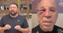 Advogados de Wanderlei anunciam ação penal contra Popó por agressão