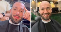 Por que Diego Hypólito está careca? Especialista analisa ginasta e revela possível uso de IA