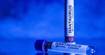 Mais de 20 franceses expostos ao hantavírus estão 'atualmente hospitalizados'