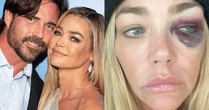 Prima de ex-marido de Denise Richards confirma acusação de agressões contra atriz, diz revista