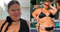 Thais Carla dá basta contra ataques após passar por cirurgia bariátrica: 'O corpo é meu'