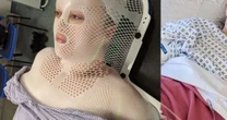 Mulher grávida de 44 anos achou que tinha distendido um músculo na aula de ioga, mas caroço na perna se revelou um câncer raro e incurável
