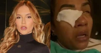 GRAVE! Mulher afirma que ficou cega após usar produto de Virginia Fonseca