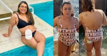 Preta quebrou tabu da bolsa de colostomia e representou pacientes abandonadas por parceiros