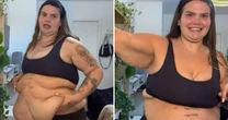 Thais Carla faz tour pelo corpo após perder 75 kg e lamenta excesso de pele: 'Incomoda'