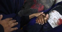 Gaza: médicos estrangeiros alertam para ferimentos 'piores que em qualquer outro conflito moderno'