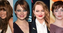 Emma Stone fez lifting facial? 35 fotos do antes e depois da atriz destacam mudança drástica na aparência em 19 anos