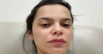 Ex-BBB Mayla Araújo é internada às pressas após inflamação causada por DIU: 'Foi um grande susto'