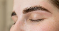 FUE Long Hair dá naturalidade ao transplante de sobrancelhas
