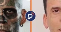 Homem mais tatuado do Brasil aparece irreconhecível após se converter e remover marcas