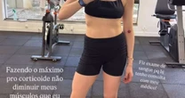 Fabiana Justus explica inchaço após ter reação ao transplante de medula: 'Uns 2 quilos'