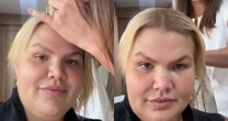 Vai ficar careca? Thais Carla expõe queda de cabelo após bariátrica: 'Isso se agravou'