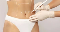 Cirurgia plástica corporal e de rejuvenescimento é tendência
