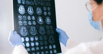 BrainAge: tecnologia indica a idade cerebral
