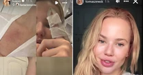 Luana Piovani compartilha supostas provas de agressão de Dado Dolabella à namorada; entenda