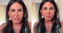 Gretchen passa por mais uma harmonização facial e apresenta novo rosto