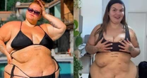 Thais Carla antes e depois: influenciadora faz 'tour' pelo corpo após perder 72 kg com bariátrica e resultado impacta. 'Rejuvenesceu 1000 anos'