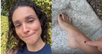 Débora Nascimento reclama de 22 picadas de mosquito ao tomar sol nua
