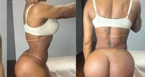 Gracyanne Barbosa ganha 20 kg em apenas três dias e choca a web; musa fitness explica mudança brusca na balança após cirurgia