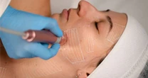 Rejuvenescimento facial movimenta setor estético no Brasil