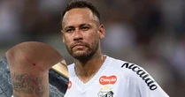 Neymar expõe ferimentos após jogo do Santos e levanta debate sobre nova lesão grave: 'Podem virar longos 10 meses'