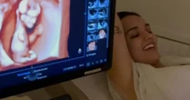 Após perda dolorosa, Rafa Kalimann emociona web ao mostrar ultrassom da filha: 'Não acho justo'