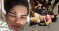 Cantora leva garrafada na cabeça durante briga e é hospitalizada