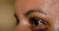 Que ele saiba que não deu certo, que estou viva, diz namorada agredida com 61 socos por ex-jogador