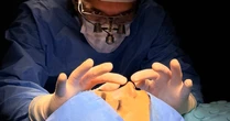 Rinoplastia ultrassônica avança em cirurgias nasais
