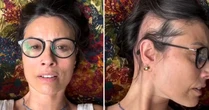 Apresentadora mostra falhas no cabelo e comove fãs ao relatar doença autoimune