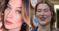 O que aconteceu com o rosto de Renata Muller? Especialista analisa antes e depois da peoa: 'Resultado artificial'
