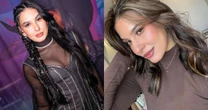 Ana Castela desmente plástica no rosto: 'Sou linda natural'