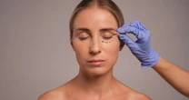 Estética do olhar adota abordagens para resultados naturais