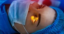 Cirurgia PRK corrige casos de miopia e astigmatismo