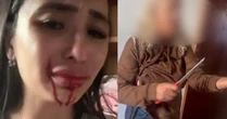 Imagens fortes! Ex-bailarina do Faustão é esfaqueada pela mãe usuária de crack: 'Tô cuspindo sangue'