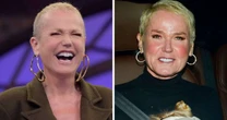 Xuxa surge com cabelos volumosos seis meses após transplante; veja antes e depois