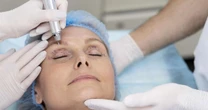 Rejuvenescimento facial alia diferentes técnicas