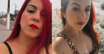 Mulher morre após cirurgia plástica em SP; polícia apura possíveis complicações médicas em 'mommy makeover'