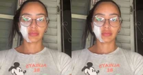 Ex-bailarina do Faustão é esfaqueada pela mãe e pede ajuda na web
